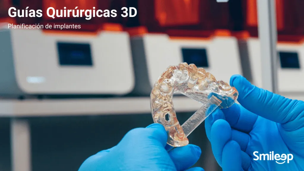 Guías Quirúrgicas 3D - Laboratorio Dental Digital