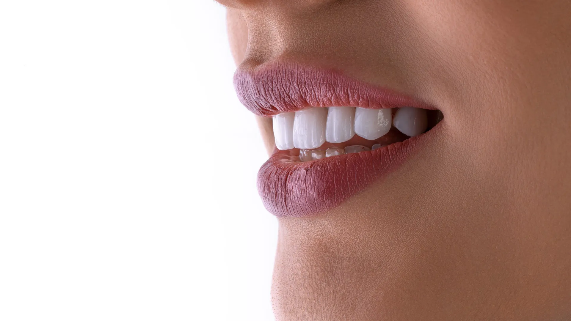 Carillas dentales fabricadas con protocolo digital de estética dental
