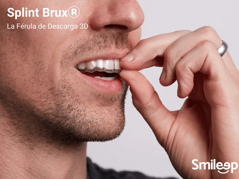 Férula de descarga digital Splint Brux® fabricada con impresión 3D