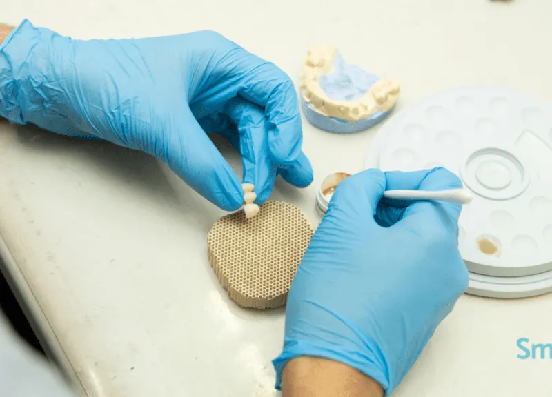 Prótesis dental fija diseñada para clínicas con flujo digital